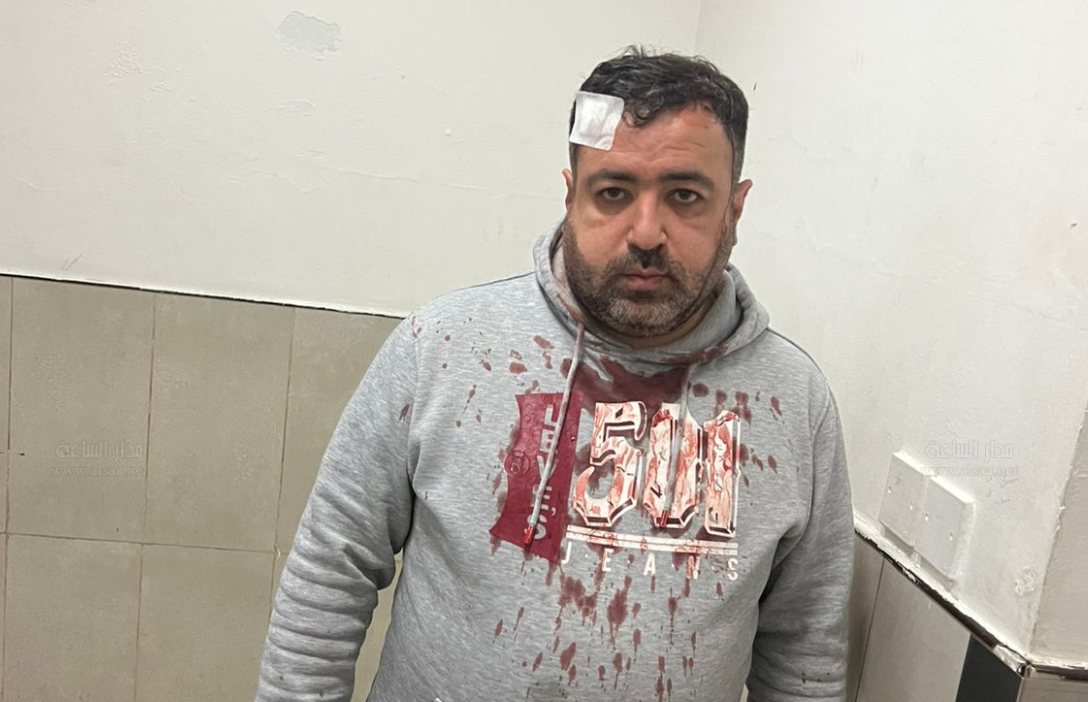 ملثمان يهاجمان الزميل الصحفي فيصل التميمي بالهراوات الحديدية أمام أطفاله وزوجته