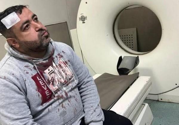 "الصحفيين" يثمن جهود الأمن في القبض على متهميْن بالاعتداء على الزميل التميمي